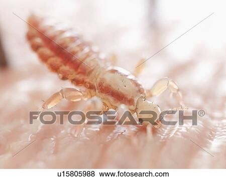 Stock Photo - Head louse, computer illustration.. Fotosearch