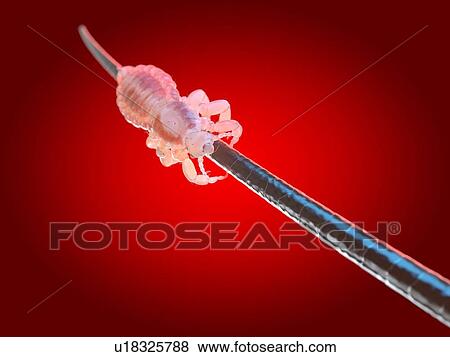 Head louse, computer illustration. View Large Photo Image Stock Photo - Head louse, computer illustration.. Fotosearch