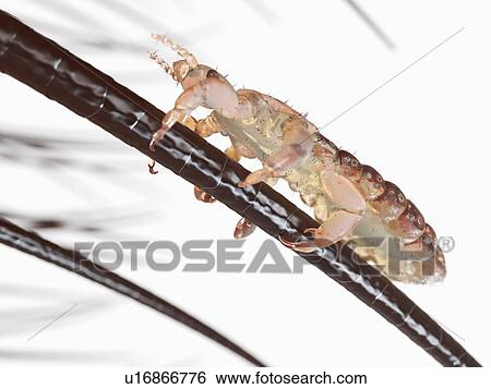 Stock Photograph - Head louse, computer illustration.. Fotosearch
