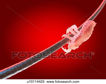 Head louse, computer illustration. View Large Photo Image Stock Photography - Head louse, computer illustration.. Fotosearch