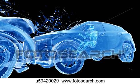 Stock Photo - Head-on car crash, computer illustration.. Fotosearch