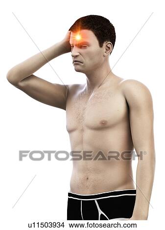 Picture - Headache, conceptual illustration.. Fotosearch