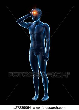 Picture - Headache, conceptual illustration.. Fotosearch