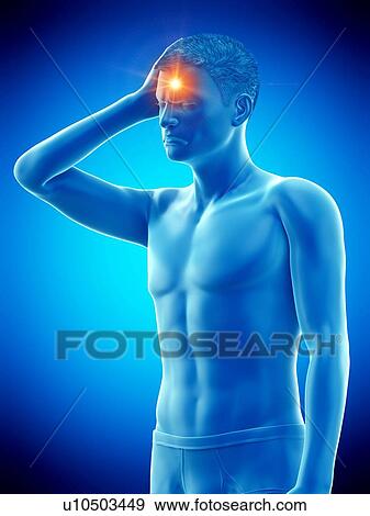 Headache, conceptual illustration. View Large Photo Image Stock Photo - Headache, conceptual illustration.. Fotosearch