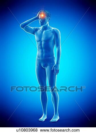 Stock Photo - Headache, conceptual illustration.. Fotosearch