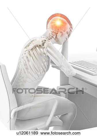 Stock Photo - Headache, conceptual illustration.. Fotosearch