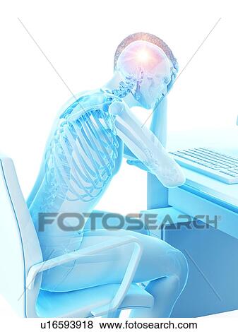 Stock Photo - Headache, conceptual illustration.. Fotosearch