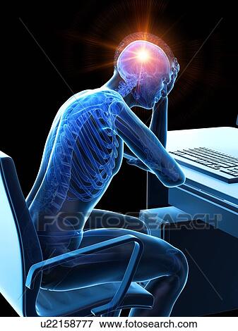 Stock Photo - Headache, conceptual illustration.. Fotosearch