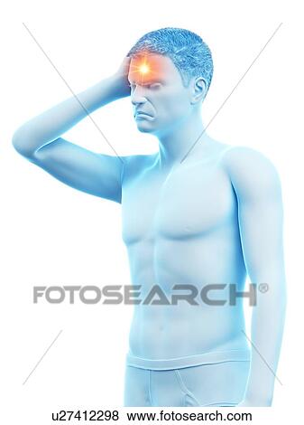 Stock Photo - Headache, conceptual illustration.. Fotosearch