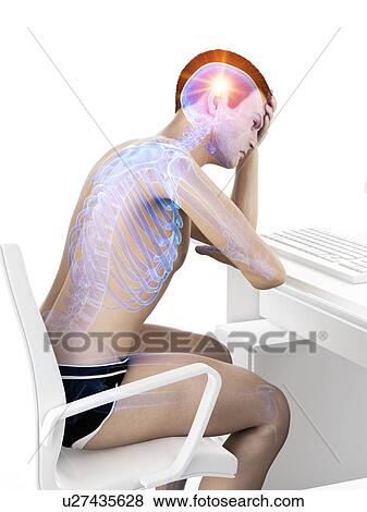 Headache, conceptual illustration. View Large Photo Image Stock Photo - Headache, conceptual illustration.. Fotosearch