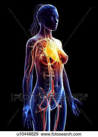 Stock Photo - Heart disease, conceptual computer illustration.. Fotosearch