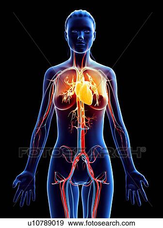 Stock Photo - Heart disease, conceptual computer illustration.. Fotosearch