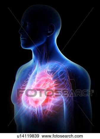 Heart disease, conceptual computer illustration. View Large Photo Image Stock Photo - Heart disease, conceptual computer illustration.. Fotosearch