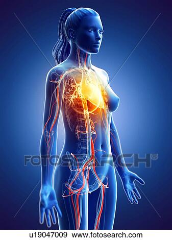 Stock Photo - Heart disease, conceptual computer illustration.. Fotosearch