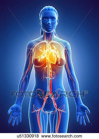 Stock Photo - Heart disease, conceptual computer illustration.. Fotosearch