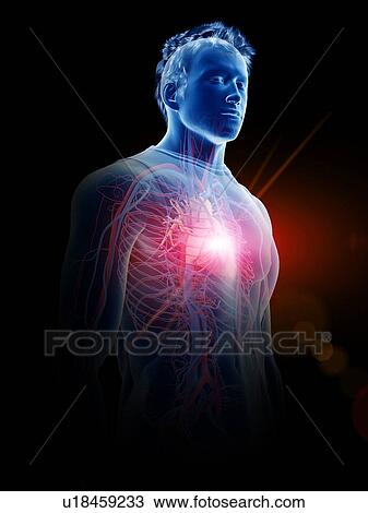 Heart disease, conceptual illustration View Large Photo Image Stock Image - Heart disease, conceptual illustration. Fotosearch