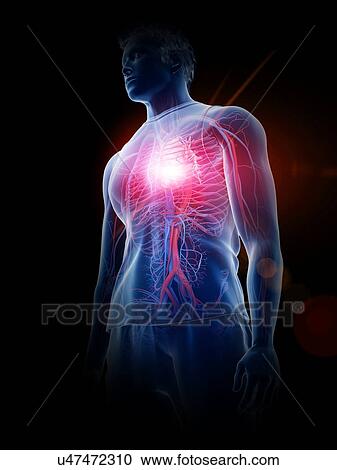 Heart disease, conceptual illustration View Large Photo Image Stock Image - Heart disease, conceptual illustration. Fotosearch