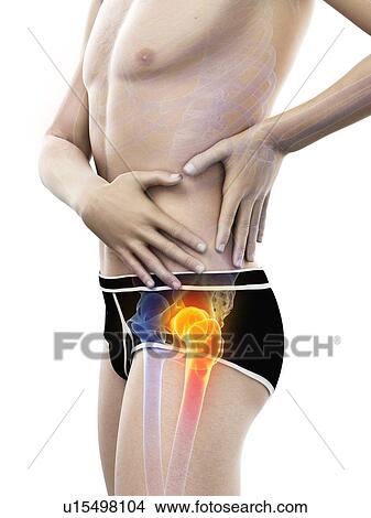 Picture - Hip pain, conceptual illustration.. Fotosearch