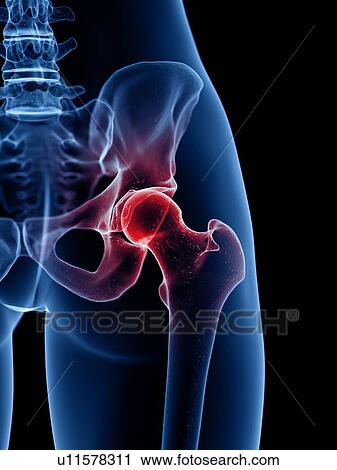 Hip pain, conceptual illustration View Large Photo Image Stock Image - Hip pain, conceptual illustration. Fotosearch
