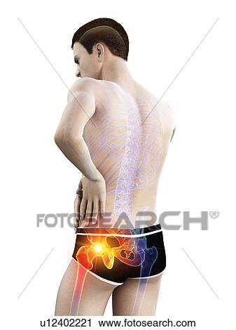 Hip pain, conceptual illustration. View Large Photo Image Stock Image - Hip pain, conceptual illustration.. Fotosearch