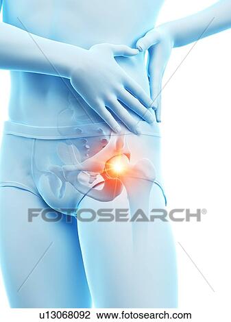 Hip pain, conceptual illustration. View Large Photo Image Stock Image - Hip pain, conceptual illustration.. Fotosearch