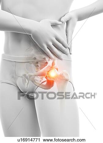 Stock Image - Hip pain, conceptual illustration.. Fotosearch