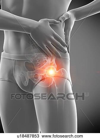 Stock Image - Hip pain, conceptual illustration.. Fotosearch
