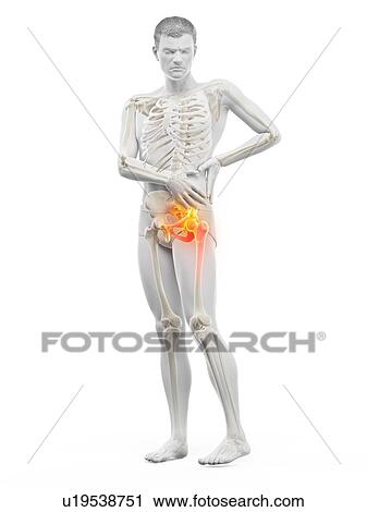 Stock Image - Hip pain, conceptual illustration.. Fotosearch
