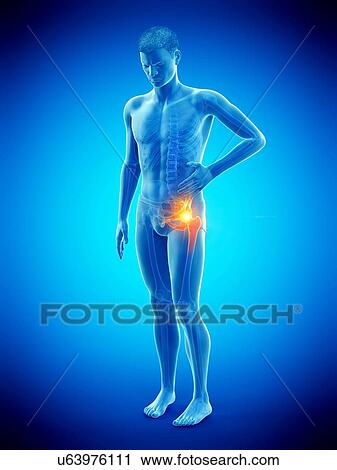 Hip pain, conceptual illustration. View Large Photo Image Stock Image - Hip pain, conceptual illustration.. Fotosearch