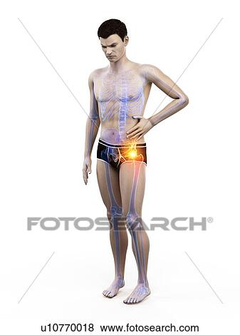 Stock Photo - Hip pain, conceptual illustration.. Fotosearch