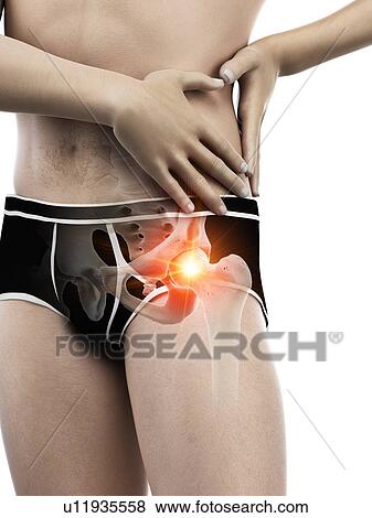 Hip pain, conceptual illustration. View Large Photo Image Stock Photo - Hip pain, conceptual illustration.. Fotosearch