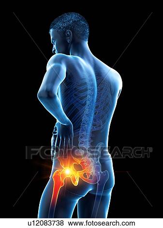 Stock Photo - Hip pain, conceptual illustration.. Fotosearch