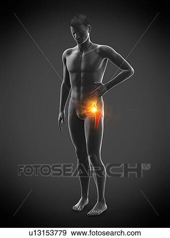 Stock Photo - Hip pain, conceptual illustration.. Fotosearch