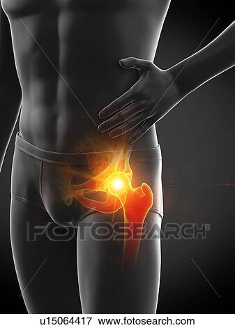 Stock Photo - Hip pain, conceptual illustration.. Fotosearch