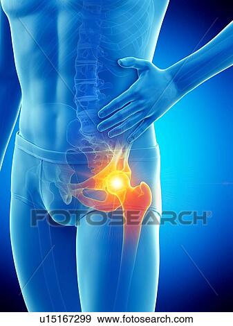 Hip pain, conceptual illustration. View Large Photo Image Stock Photo - Hip pain, conceptual illustration.. Fotosearch
