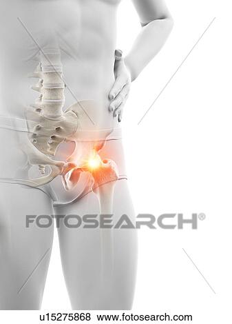 Hip pain, conceptual illustration. View Large Photo Image Stock Photo - Hip pain, conceptual illustration.. Fotosearch