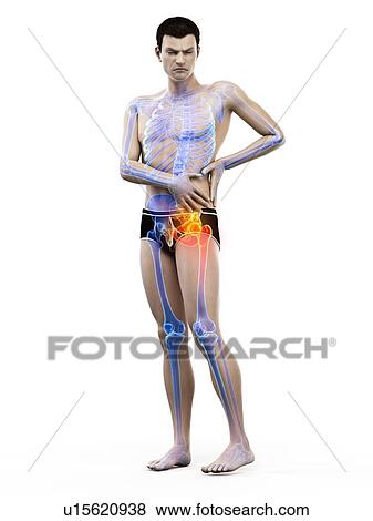 Stock Photo - Hip pain, conceptual illustration.. Fotosearch
