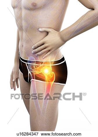 Stock Photo - Hip pain, conceptual illustration.. Fotosearch