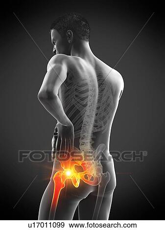 Hip pain, conceptual illustration. View Large Photo Image Stock Photo - Hip pain, conceptual illustration.. Fotosearch