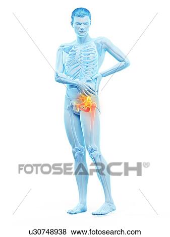 Stock Photo - Hip pain, conceptual illustration.. Fotosearch