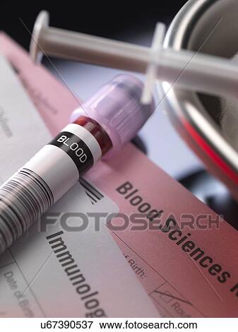 Human blood sample alongside blood test request form. View Large Photo Image Stock Photo - Human blood sample alongside blood test request form.. Fotosearch