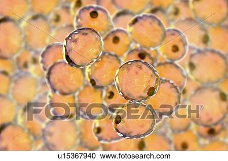 Stock Image - Human fat cells, computer illustration.. Fotosearch