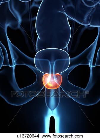 Picture - Inflamed prostate, illustration. Fotosearch
