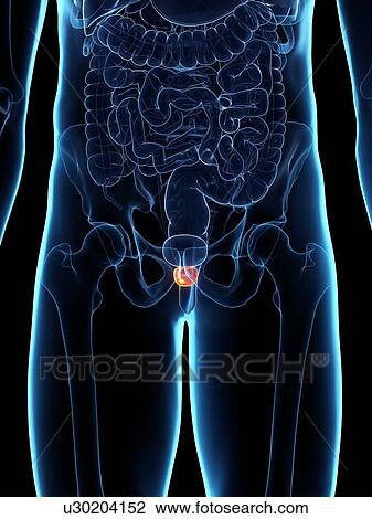 Inflamed prostate, illustration View Large Photo Image Stock Image - Inflamed prostate, illustration. Fotosearch