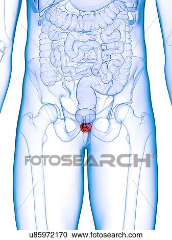 Stock Image - Inflamed prostate, illustration. Fotosearch
