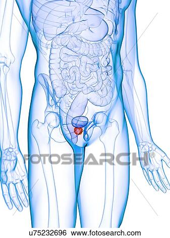 Stock Photograph - Inflamed prostate, illustration. Fotosearch