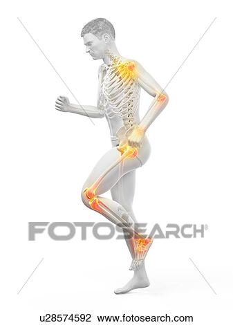 Stock Image - Joint pain, conceptual illustration.. Fotosearch