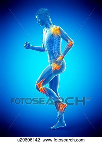 Stock Image - Joint pain, conceptual illustration.. Fotosearch