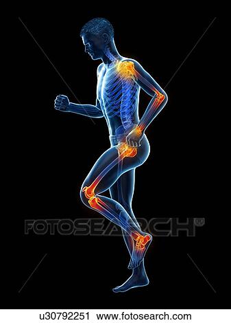Stock Image - Joint pain, conceptual illustration.. Fotosearch