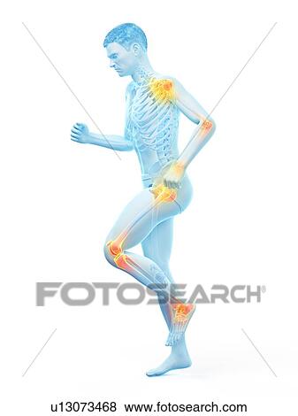 Stock Photo - Joint pain, conceptual illustration.. Fotosearch